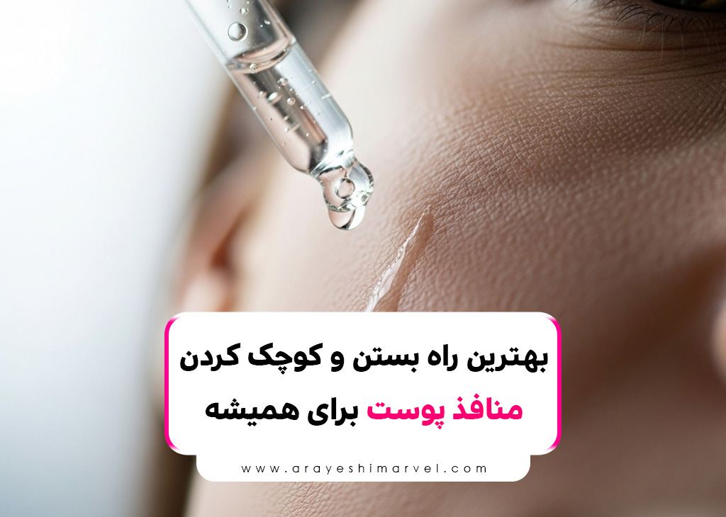 بهترین راه بستن و کوچک کردن منافذ پوست برای همیشه